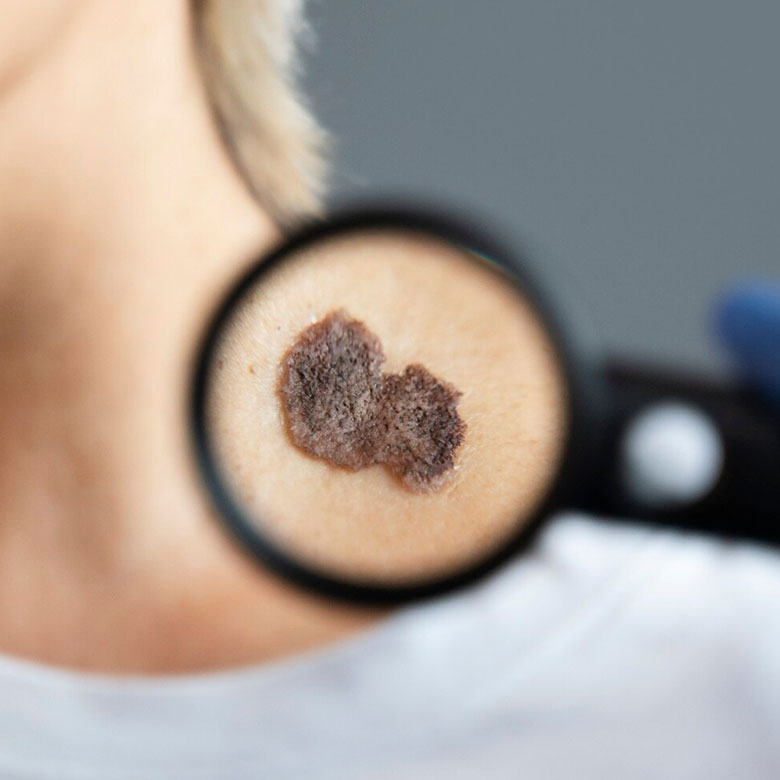  <span class="lte-header lte-h4"> Mënyrat natyrore për trajtimin e problemeve të lëkurës </span> 